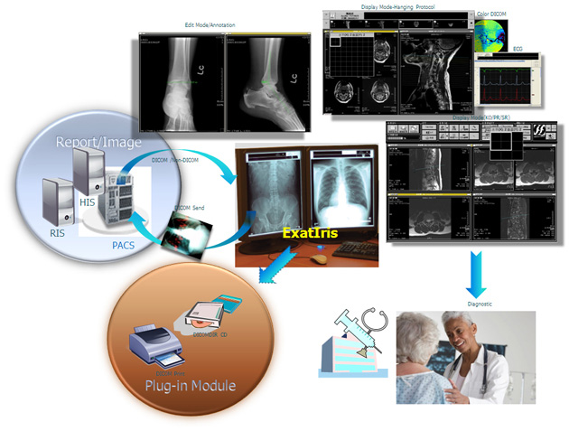 ExaCapture workflow
